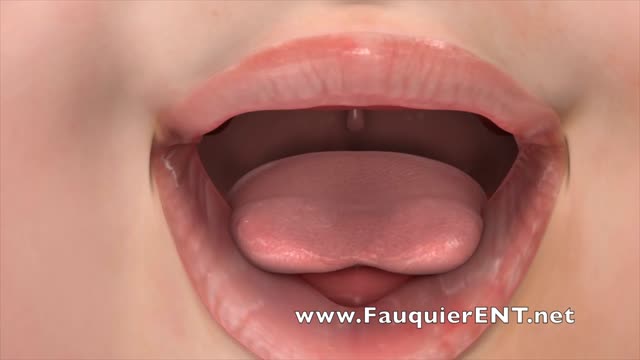 ⁣Tongue Tie Release Treatment