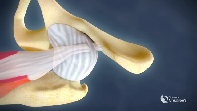 Surgical Treatment for Dysplastic Hip