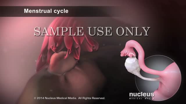 INTRAUTERINE INSEMINATION :