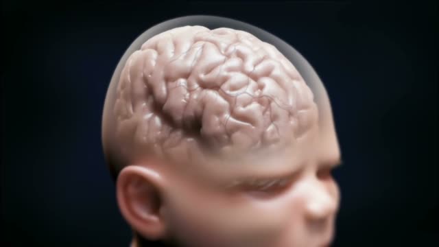 Shaken Baby Syndrome Brain Injury