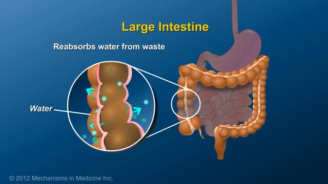 What is an Ileostomy?