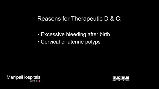 ⁣Dilation And Curettage Uterus