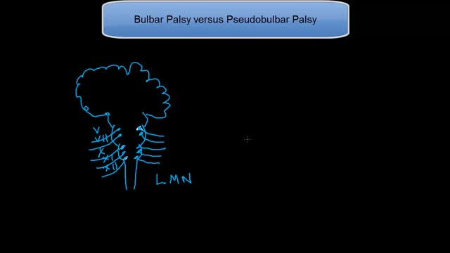 ⁣Bulbar Palsy versus Pseudobulbar Palsy