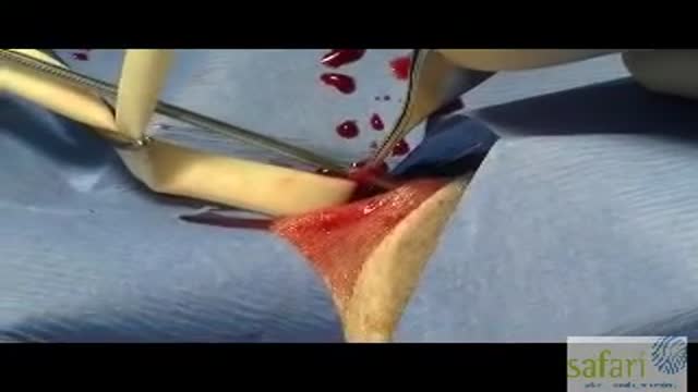 Heartworm Extraction Surgery