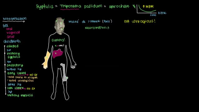 ⁣Tertiary Syphilis