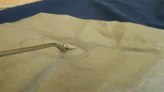 Laparoscopic Vaginal Top Closure