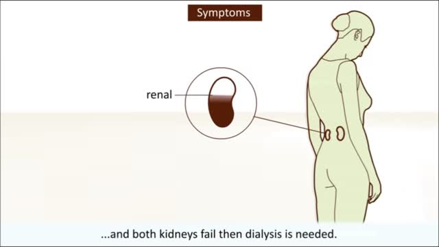 Kidney Transplant & Dialysis