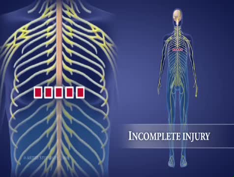 ⁣Levels of Spinal Cord Injury