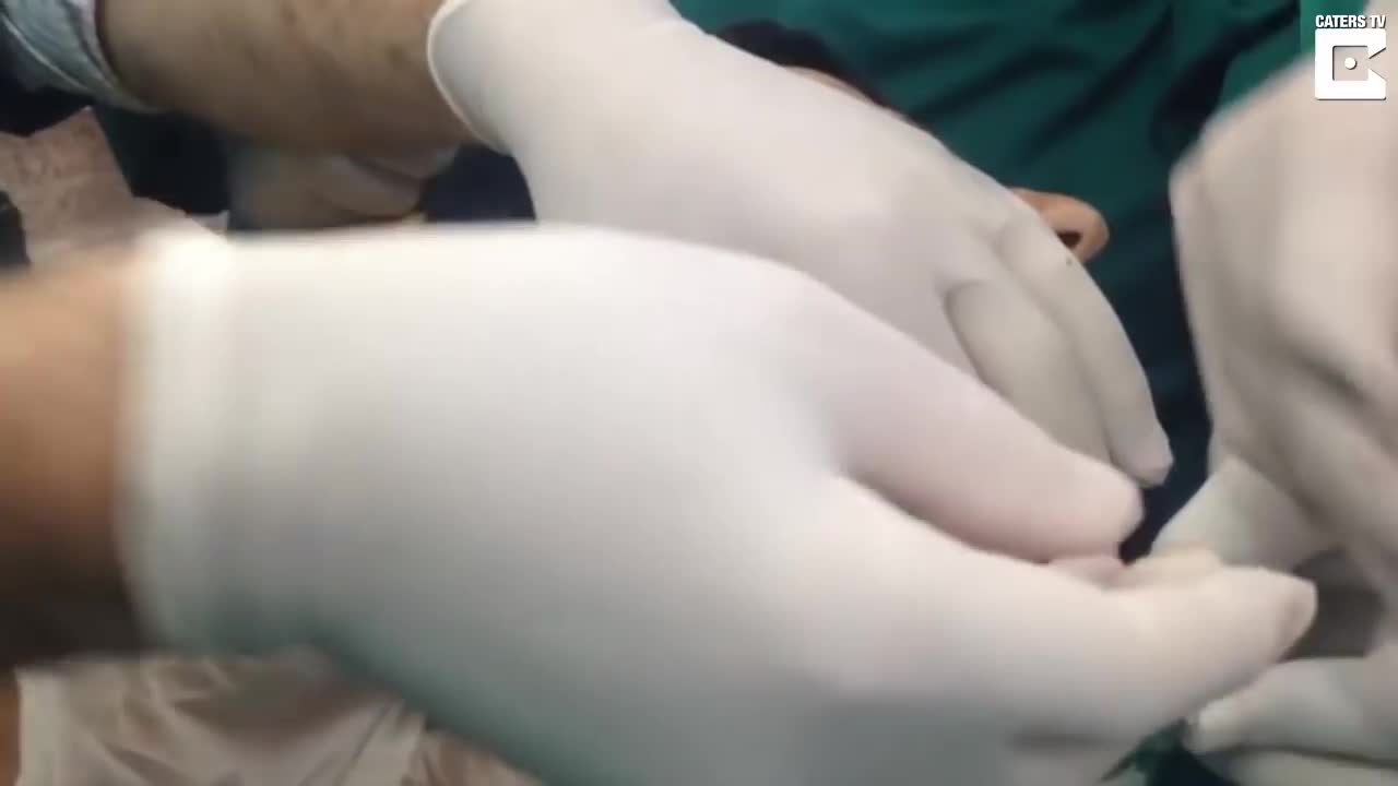 Huge Abscess On Man's Jaw