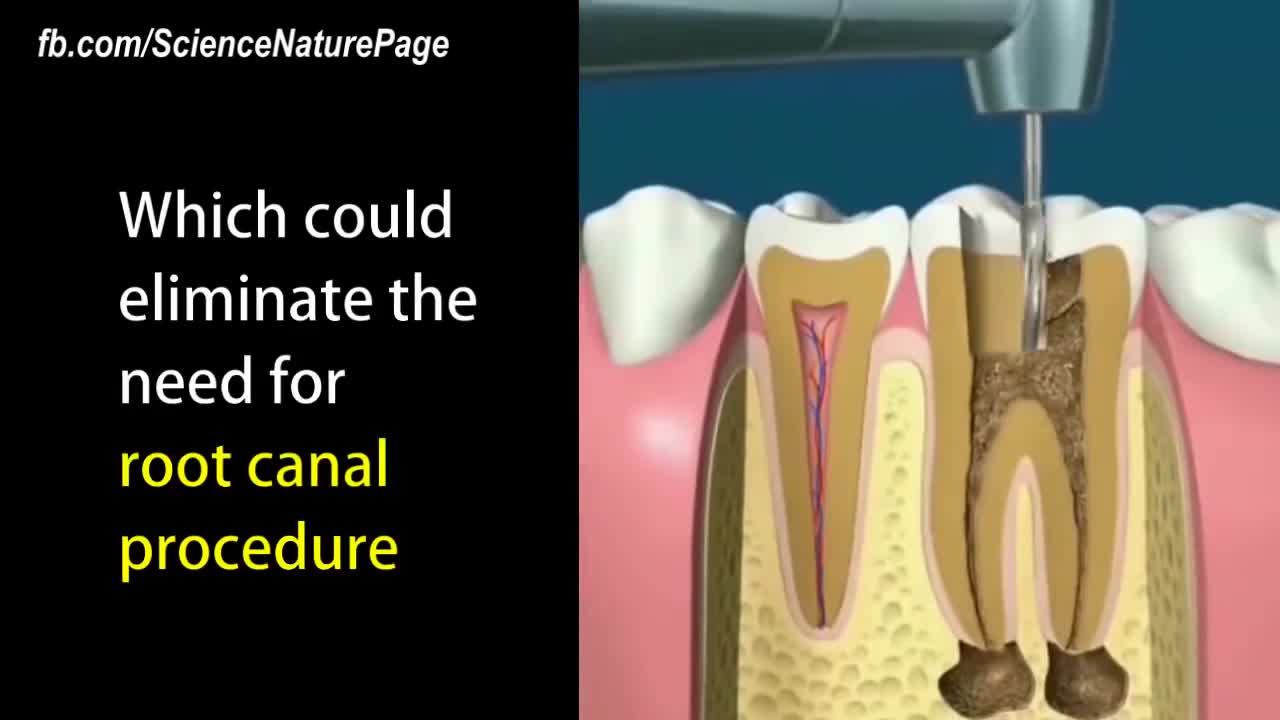 ⁣New Regenerative Dental Fillings