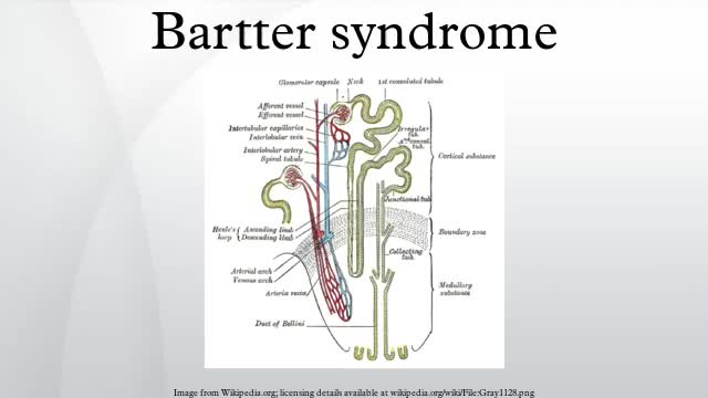 ⁣Bartter syndrome