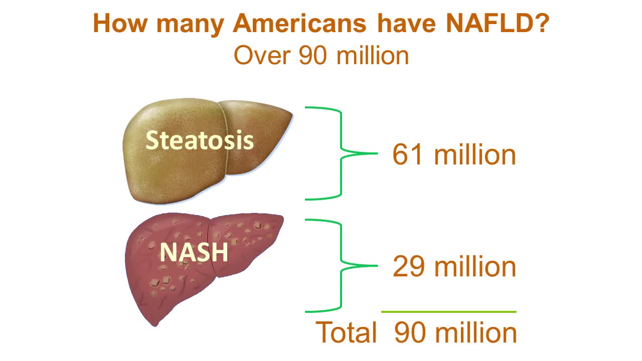 Non-Alcoholic Fatty Liver Disease