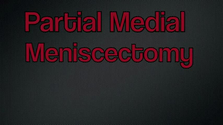 ⁣Partial Medial Meniscectomy Arthroscopغ
