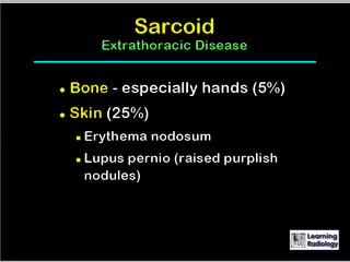 ⁣Sarcoidosis Diagnosis