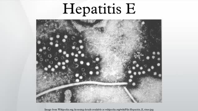 ⁣Hepatitis E Features