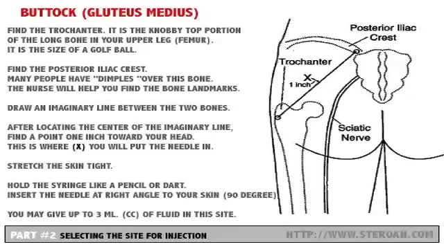 ⁣How to inject IM: Selecting The Site For Injection